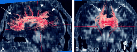 Fig 3.