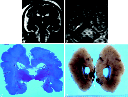 Fig 1.