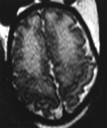 Fig 3.