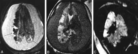 Fig 4.