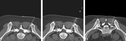 Fig 3.