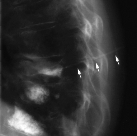 Fig 1.