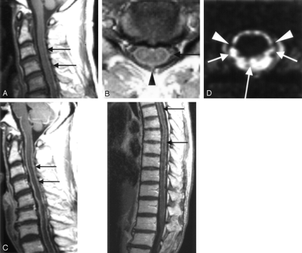 Fig 1.