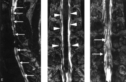Fig 1.
