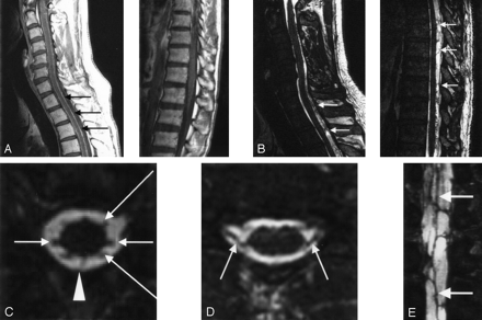 Fig 2.