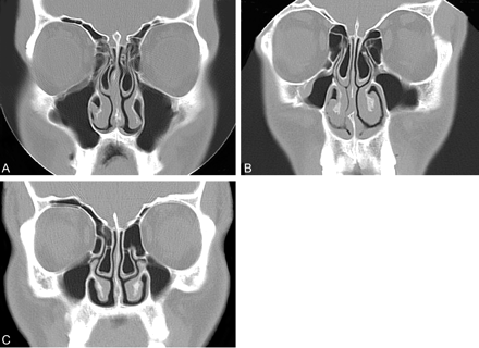 Fig 4.