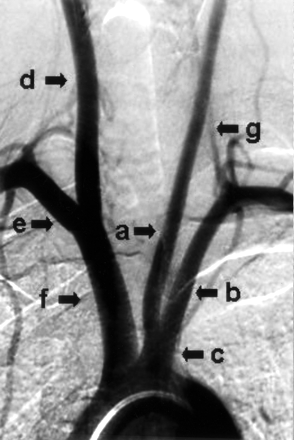 Fig 1.