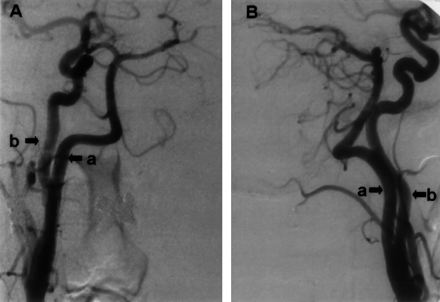 Fig 2.