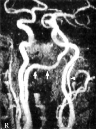 Fig 1.