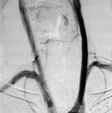 Fig 2.