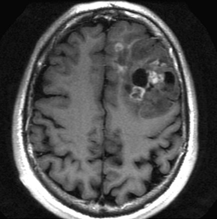 Fig 2.