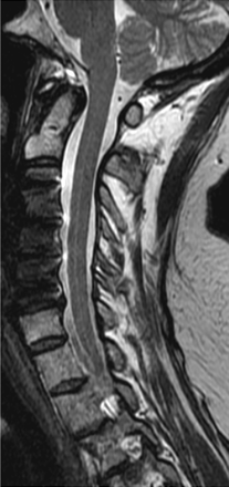 Fig 3.