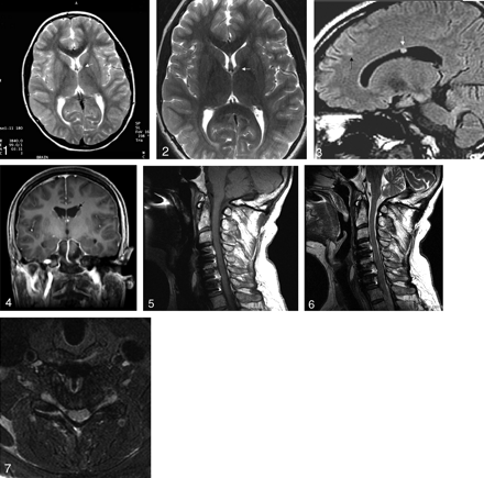 Fig 4.