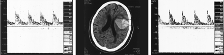Fig 2.