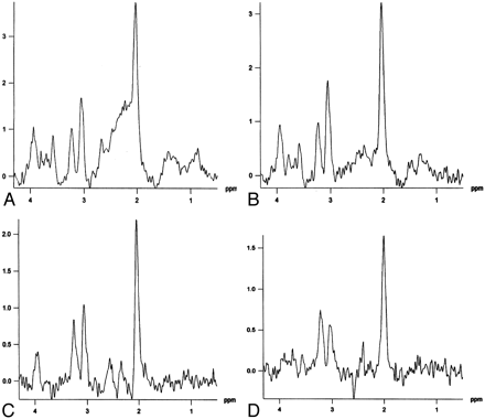 Fig 3.