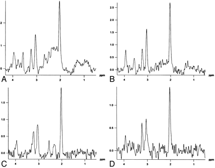 Fig 4.