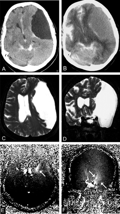 Fig 4.