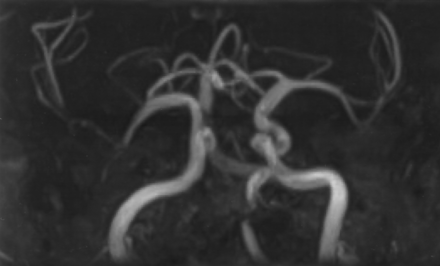 Fig 1.