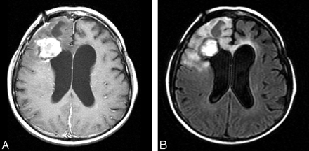 Fig 3.