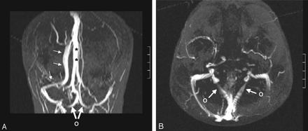 Fig 2.