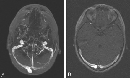 Fig 4.