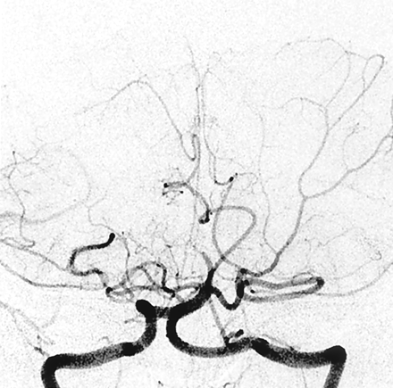 Fig 3.