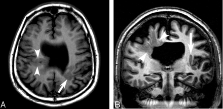 Fig 1.