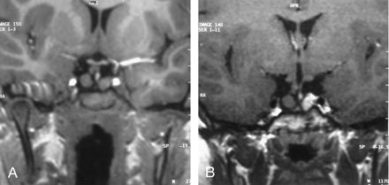 Fig 1.