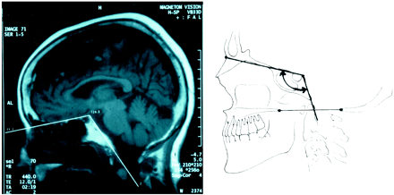 Fig 2.