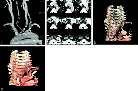 Fig 4.