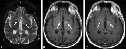 Fig 2.