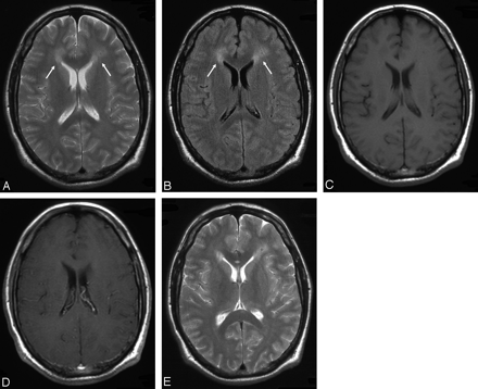 Fig 6.