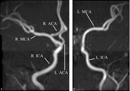 Fig 2.