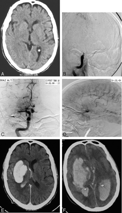 Fig 1.