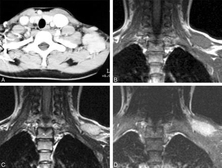 Fig 3.