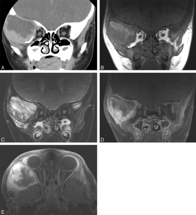 Fig 4.