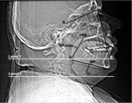 Fig 2.