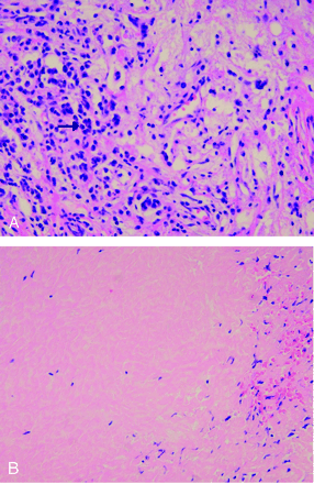 Fig 4.