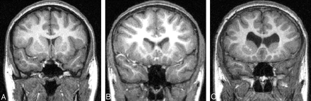 Fig 2.