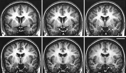 Fig 3.