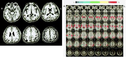 Fig 5.