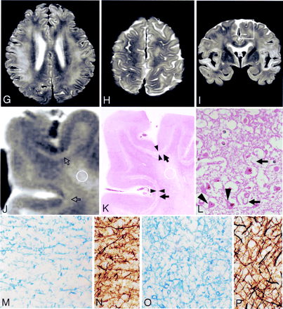 Fig 1.
