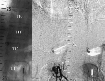 Fig 4.