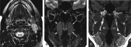 Fig 1.