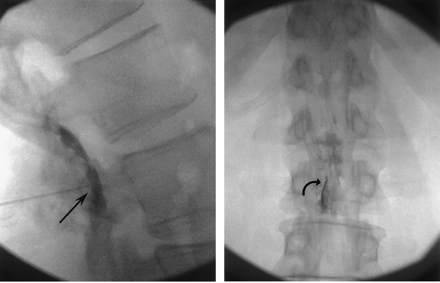 Fig 3.