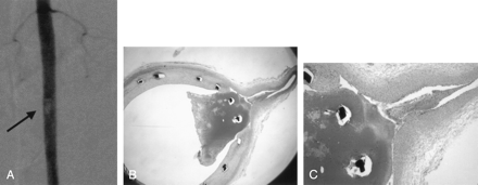 Fig 4.