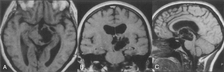 Fig 1.