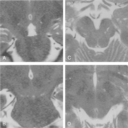 Fig 3.