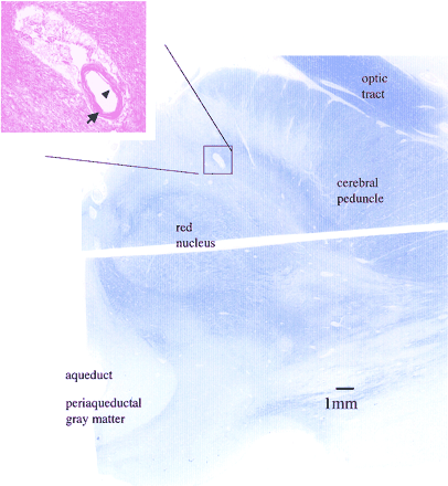 Fig 4.