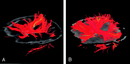 Fig 4.